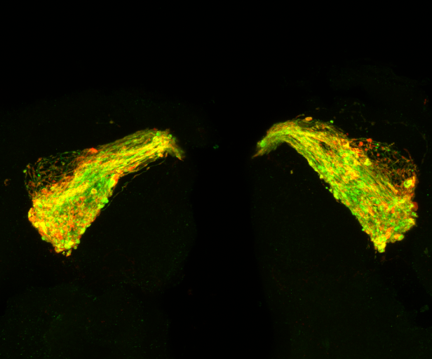 An image of a fruit fly's brain