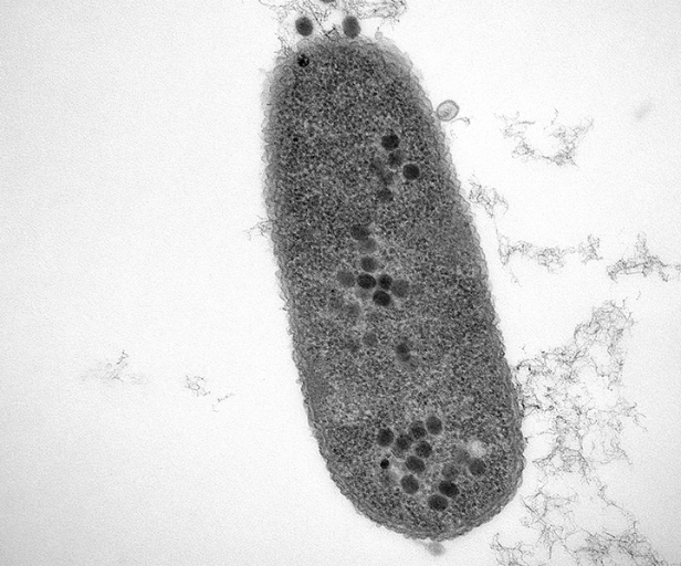 New insights could help phages defeat antibiotic resistant bacteria