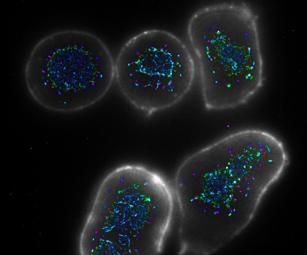 Researchers find promising new way to boost the immune response to cancer